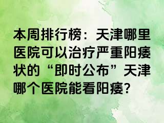 本周排行榜：天津哪里医院可以治疗严重阳痿状的“即时公布”天津哪个医院能看阳痿？